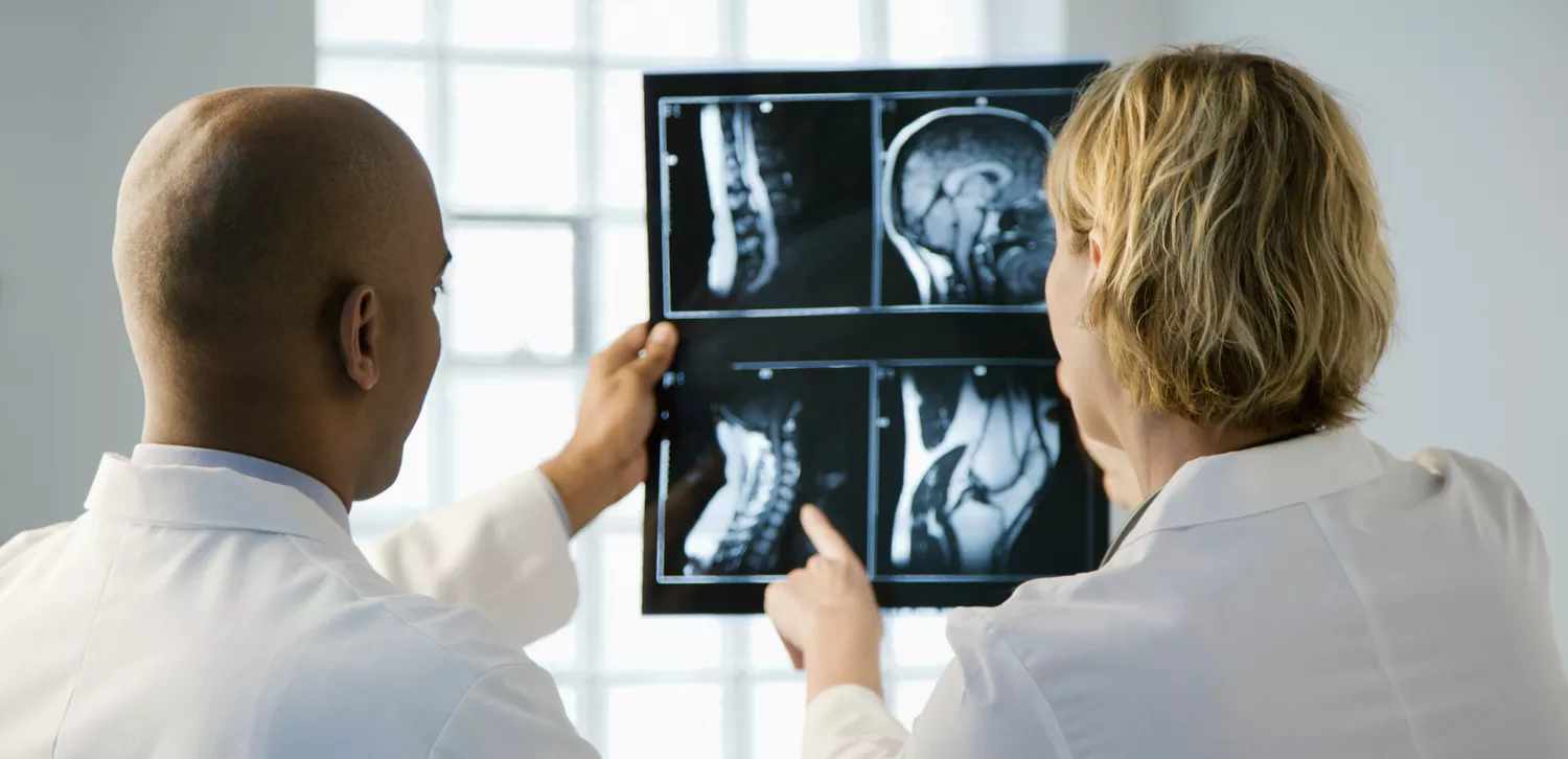 Clinicians reviewing an MRI brain scan